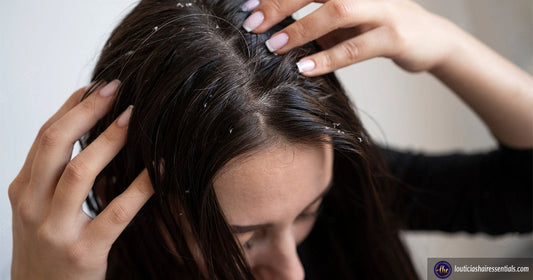 Main Reasons For Unhealthy Scalp